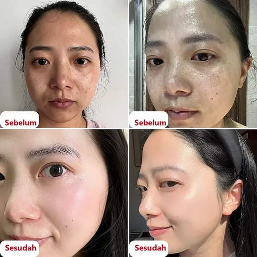 Foto sebelum dan sesudah pelanggan