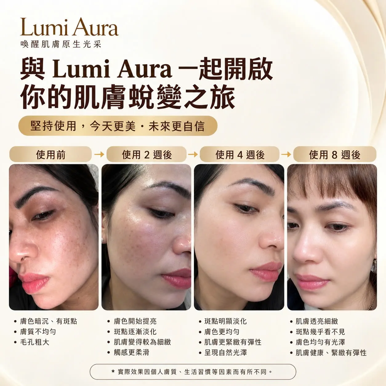 與 LumiAura 一起開啟肌膚蛻變之旅：使用前、使用 2 週後、使用 4 週後、使用 8 週後的膚況變化