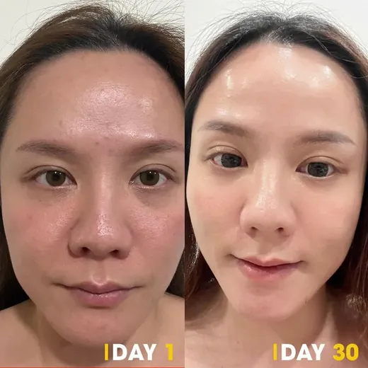 Before at after na larawan ng customer