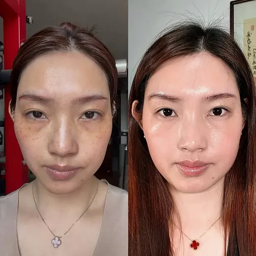 Before at after na larawan ng customer