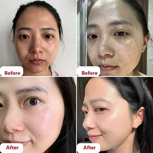 Before at after na larawan ng customer
