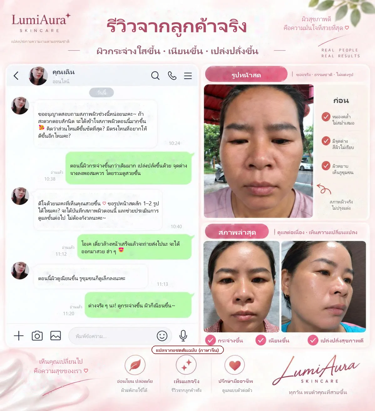 รีวิวจากลูกค้าจริง: แชต LINE และรูปหน้าสดก่อนและหลัง