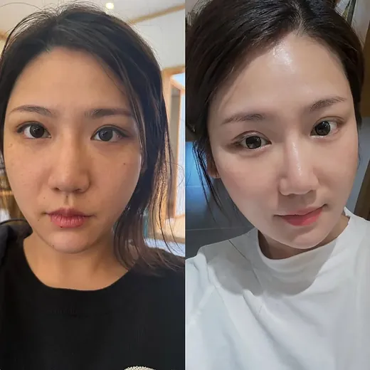 Ảnh trước và sau của khách hàng