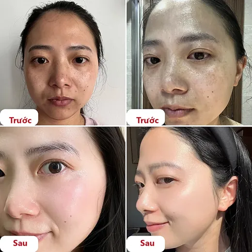Ảnh trước và sau của khách hàng